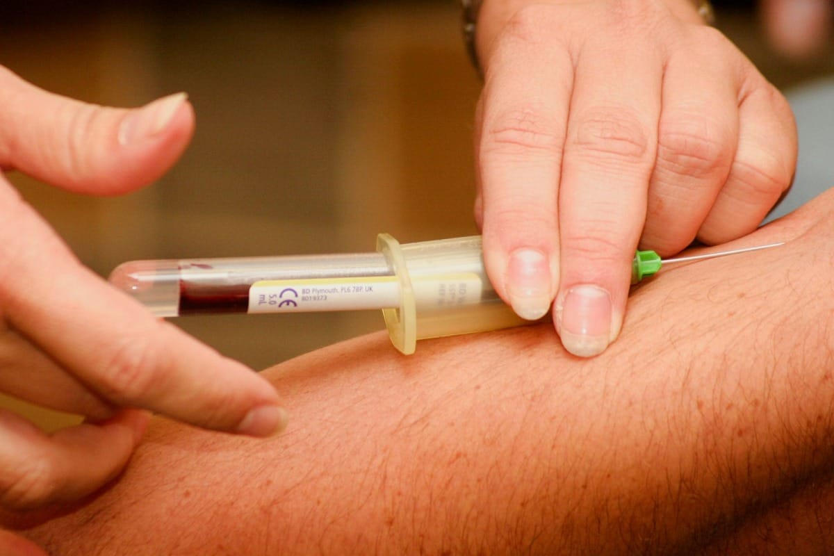 taking a blood sample from arm